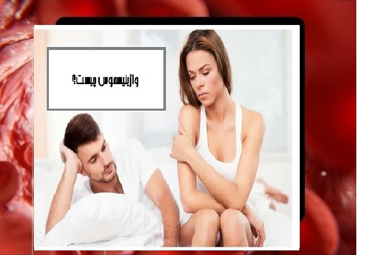 واژینیسموس چیست