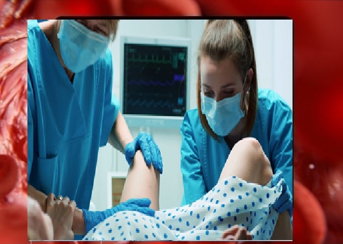 اپیزیوتومی